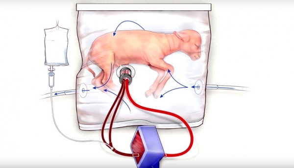 人造子宫可培育小羔羊 或将用于早产儿治疗