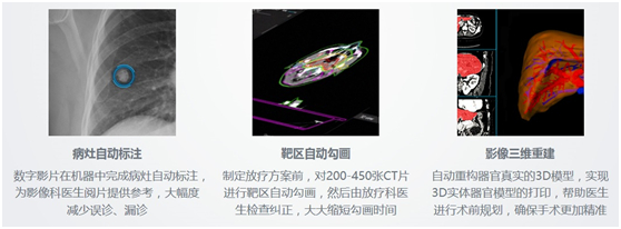 真的发生了,人工智能救了我一命
