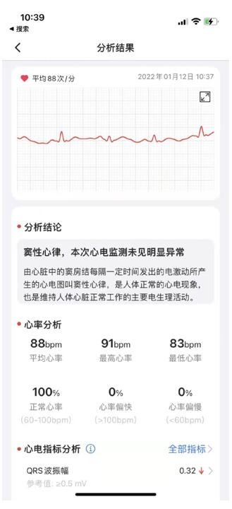 гƷ +APP