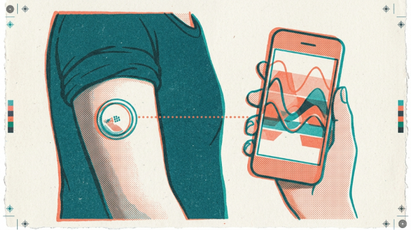 Dexcom��Ϊ�׼Ҽ�������FDA��CMS���ֽ��������Ե���Ŀ����ҵ